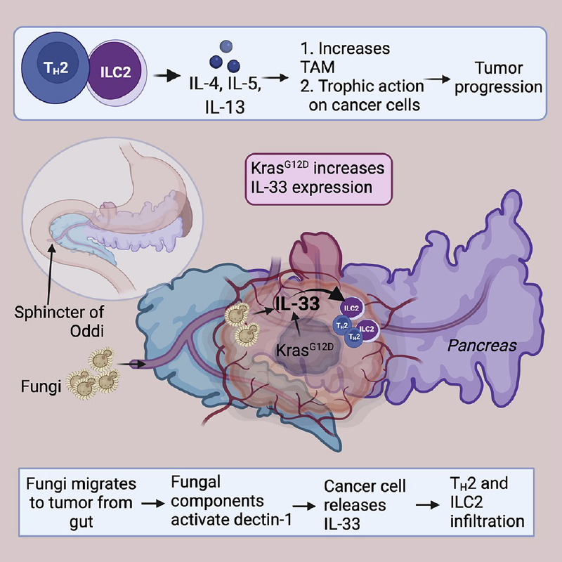 Graphic depiction of roles of oncogenic KRAS and intratumoral fungi in promoting immune-modulating cytokine IL33 in pancreas cancer.